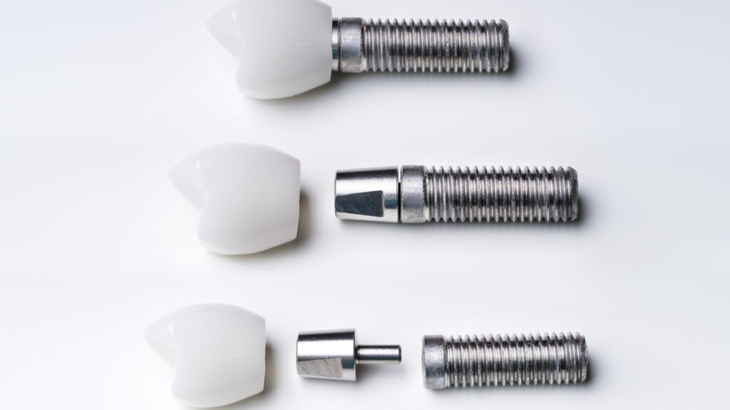 Dental implant parts