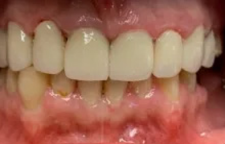 Before dental treatment
