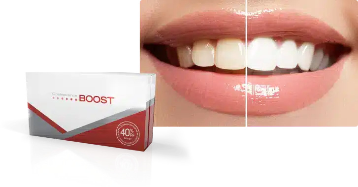 Boost Teeth Whitening