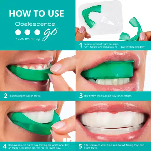 Opalescence teeth whitening how to use