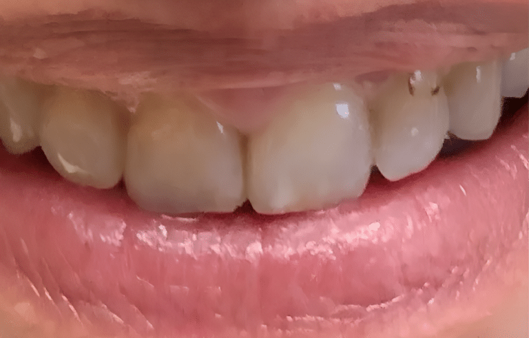 Smile gallery before