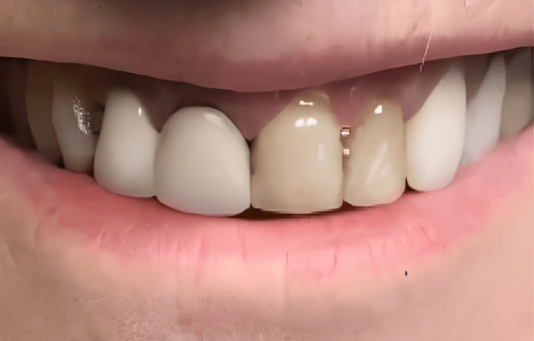 Smile gallery before