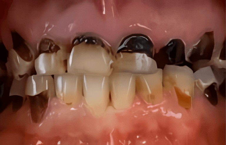 Smile gallery before