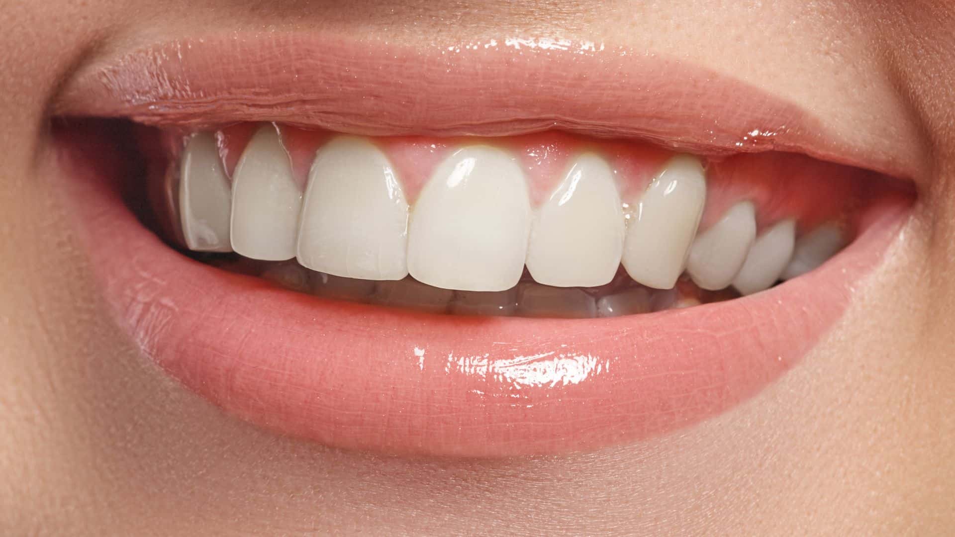Whitening